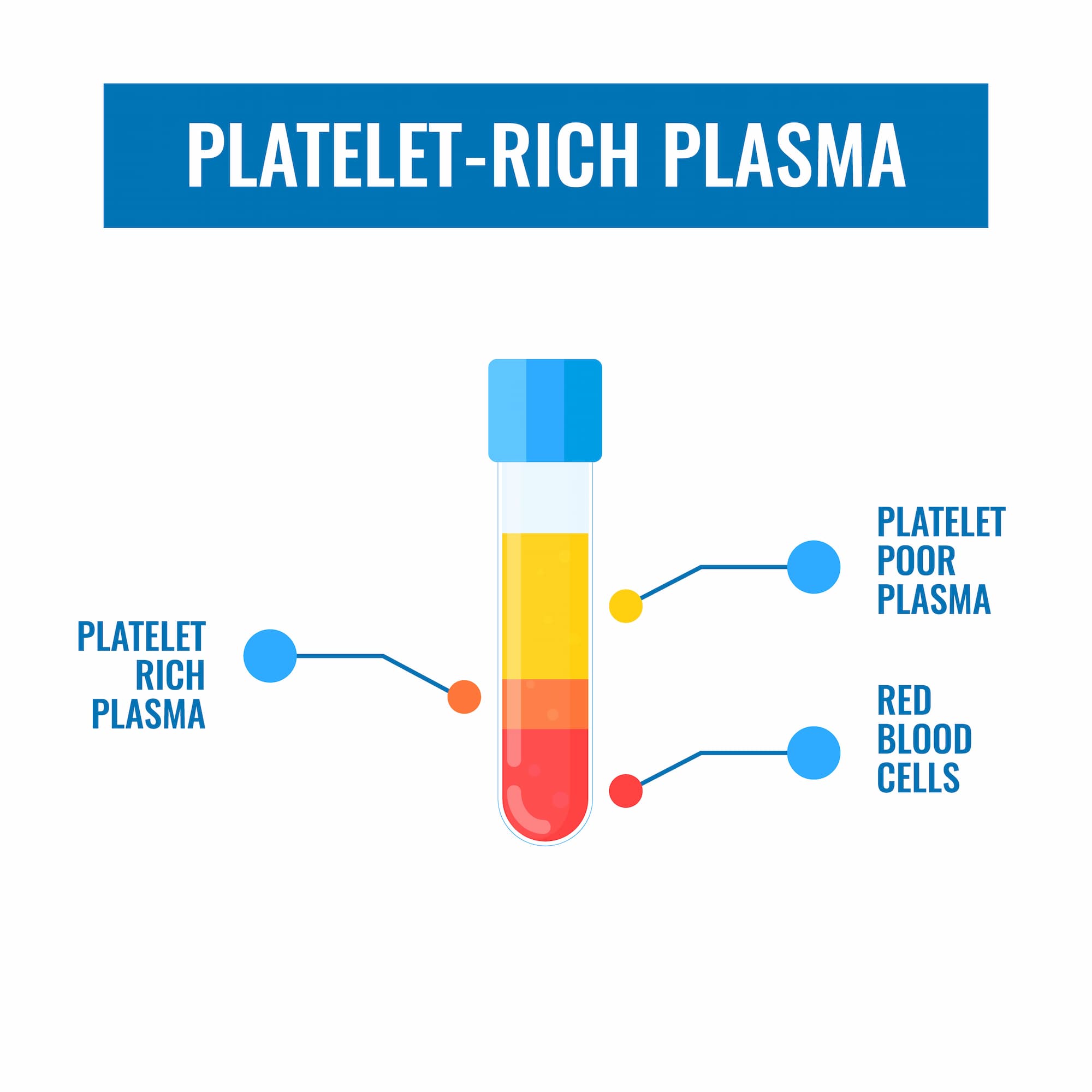 PRP (Platelet Rich Plasma) Injections, Therapy And Treatment | Mr ...