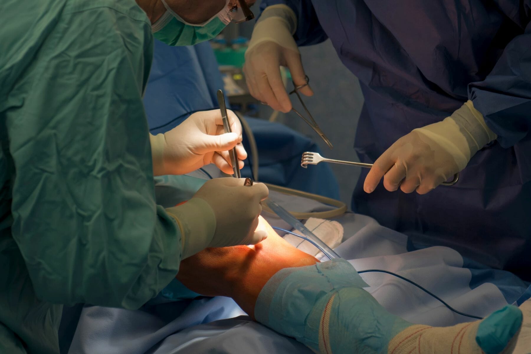 two doctors performing a knee replacement surgery