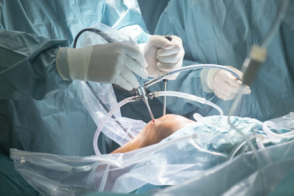 knee surgery