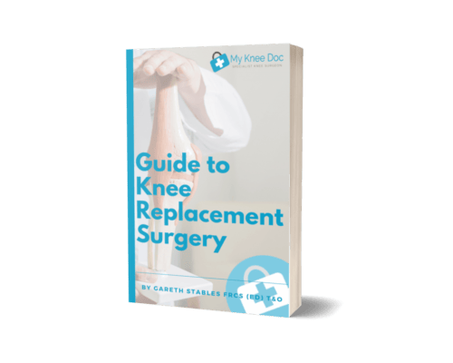 guide to knee replacement