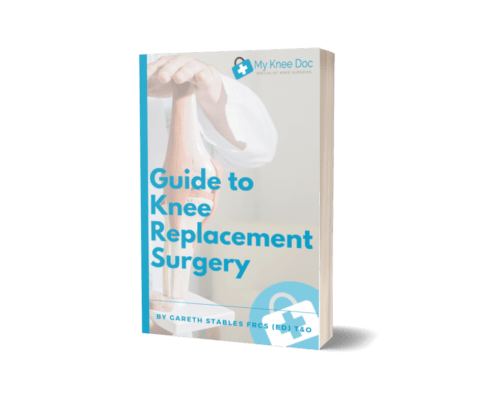 guide to knee replacement guide to knee replacement